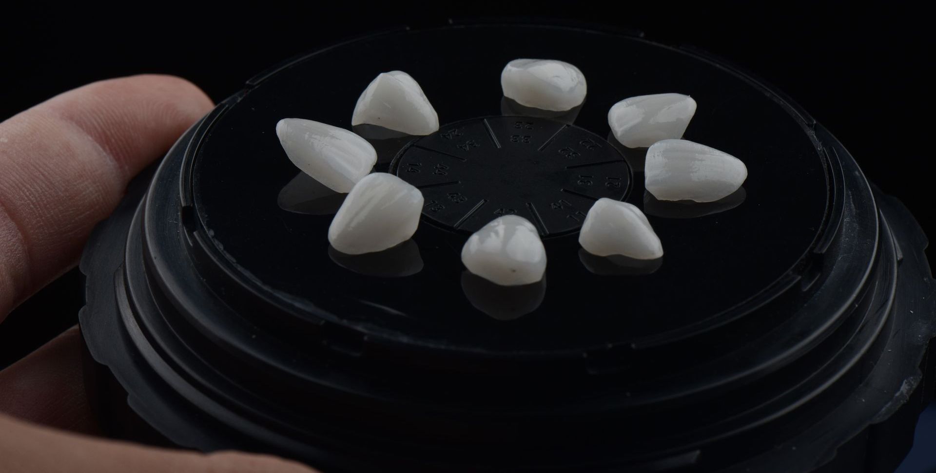 PORCELAIN VENEERS & NO-PREP VENEERS - TLC Dental Wellness