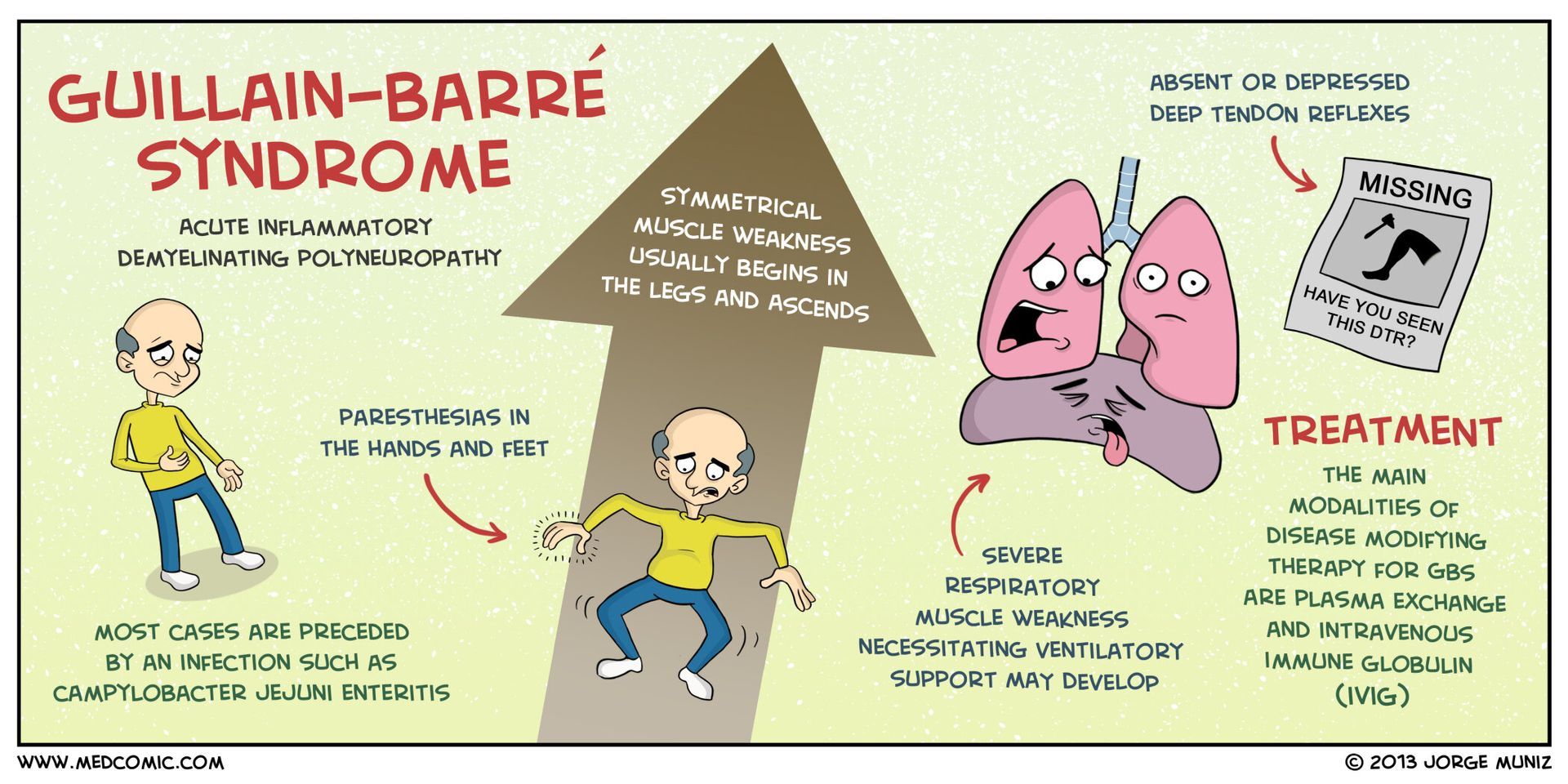 A cartoon of a man with guillain-barre syndrome