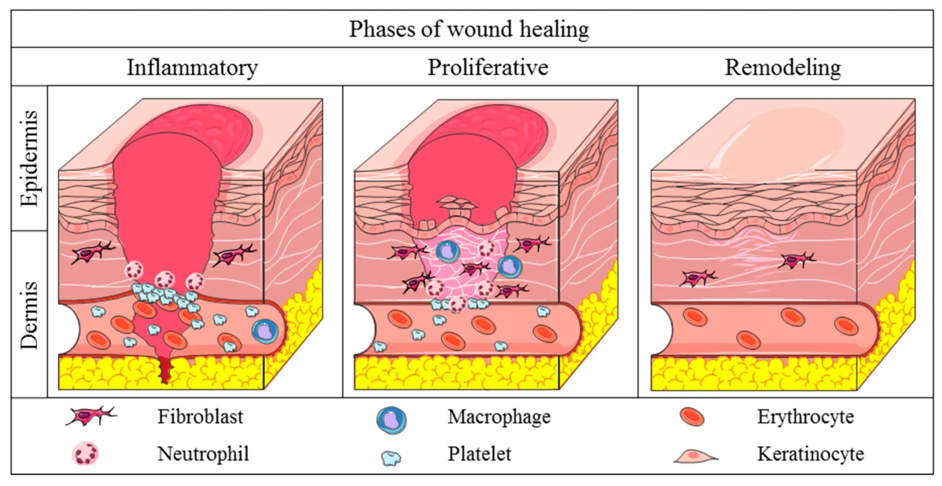 Drawing of the phases of wound healing
