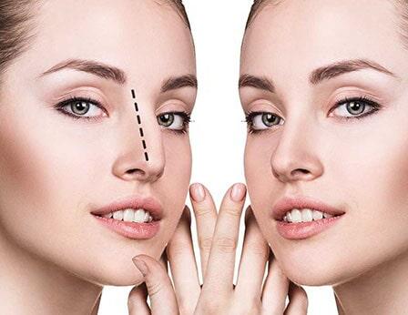 DR. OCTAVIO DELFÍN ORTEGA OTORRINOLARINGÓLOGO – ESTETICA FACIAL