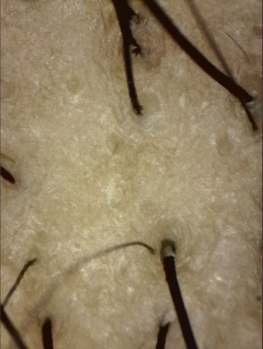 imagenes de capilografo de cuero cabelludo