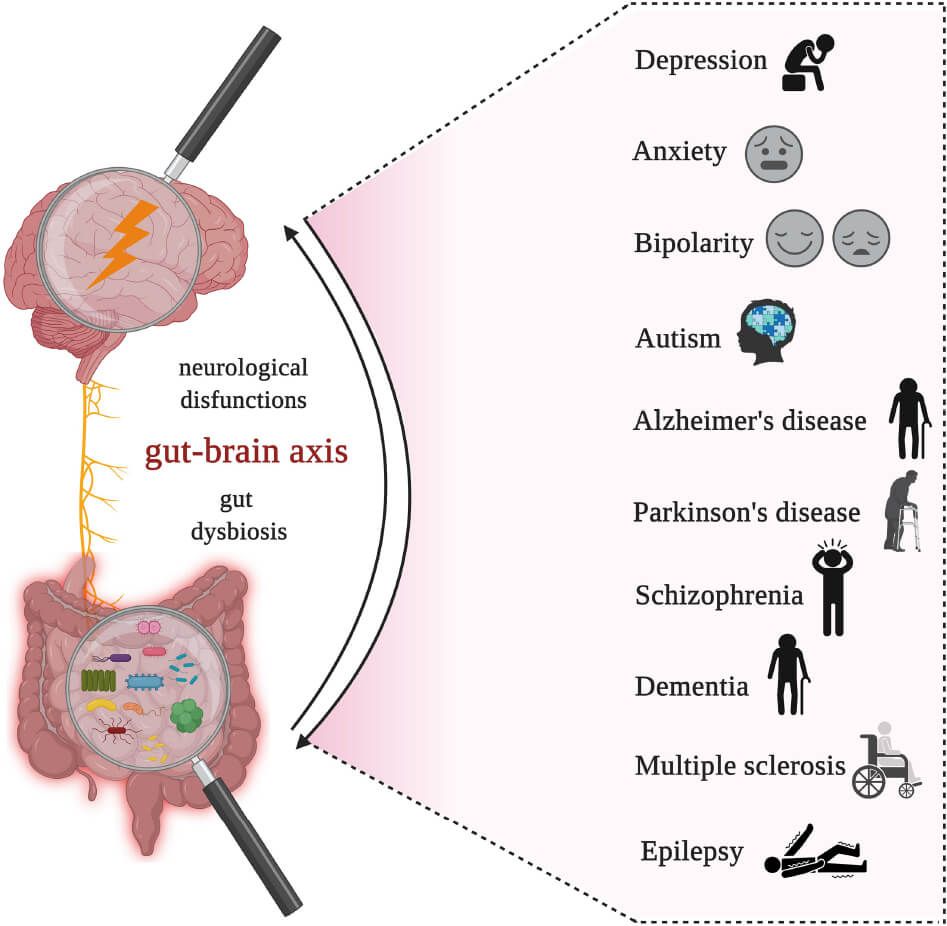 Gut inflammation and mental health