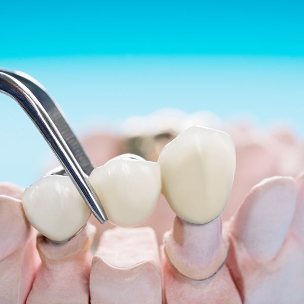A close up of a person 's teeth being examined by a dentist.