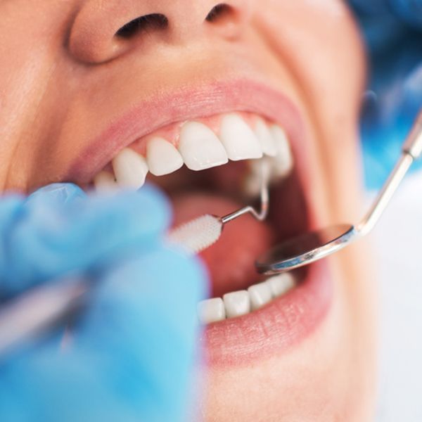 Dental Checkup Paddington, QLD Dental Checkup Paddington, QLD