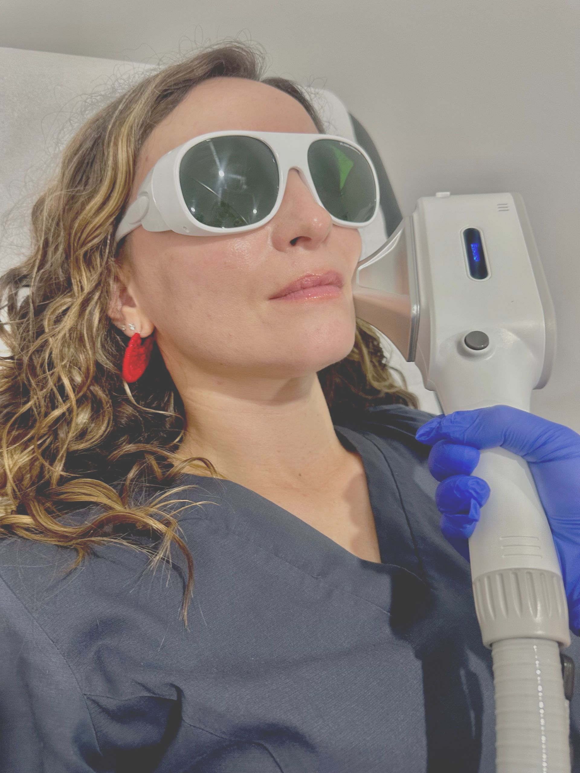 A Person Wearing Protective Goggles Receives A Laser Skin Treatment — Hope Laser and Beauty Clinic in Taree, NSW