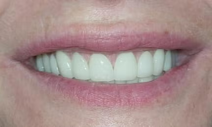 Close-up of a smiling mouth with straight white teeth and pink lips