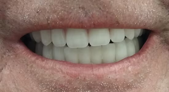 Close-up of a person smiling, showing white teeth and part of their lips and chin.