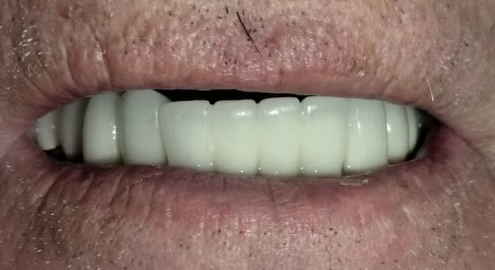 Close-up of a smiling mouth showing white teeth and lips