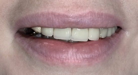 Close-up of a smiling mouth showing white teeth and pink lips