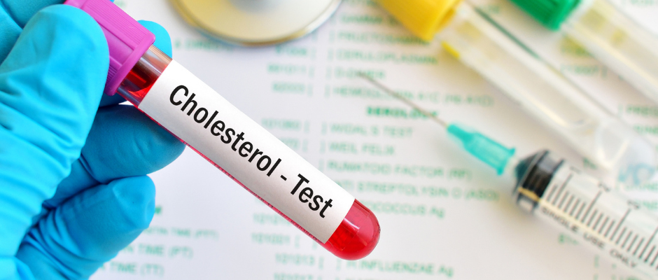 Cholesterol Testing | PrimeMed