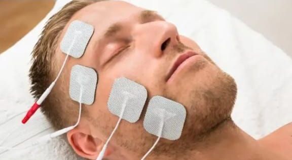 Hombre tumbado en una mesa con electrodos de electroterapia adheridos a la cara y al cuello.