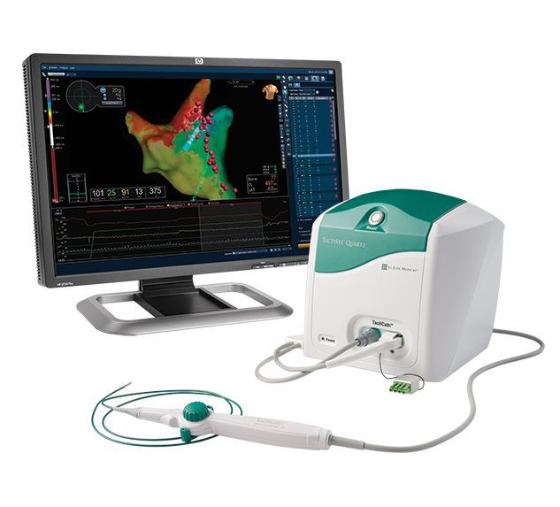 Ablação Para Fibrilação Atrial e Outras Arritmias Complexas com o Uso do Sistema de Mapeamento Eletroanatômico 3D Ensite Velocity. Ablação Para Fibrilação Atrial e Outras Arritmias Complexas com o Uso do Sistema de Mapeamento Eletroanatômico 3D Ensite Velocity.