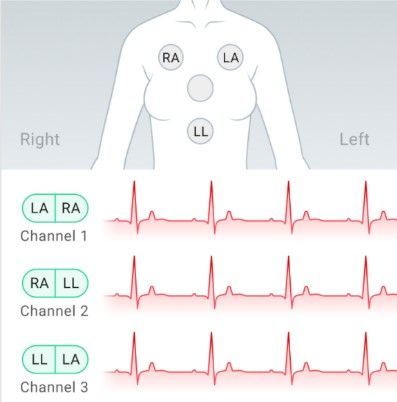 Holter de 24h Holter de 24 em Maringá - Clínica de Arritmias Maringá