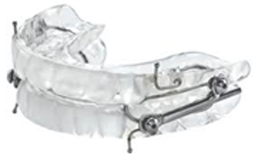 DORSAL — The Center for Sleep Apnea and TMJ — Boise, ID
