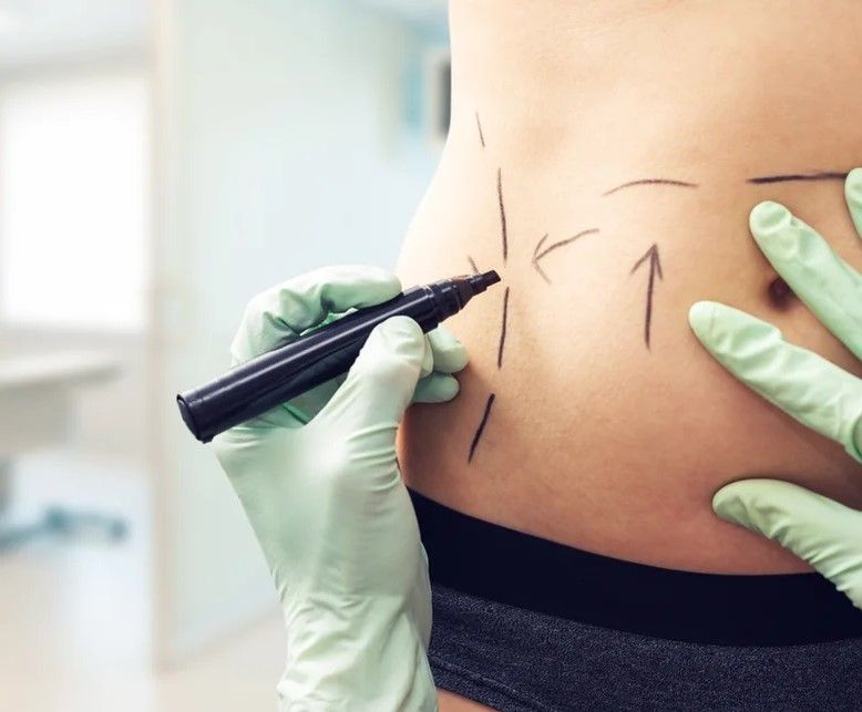 cosmetic surgery