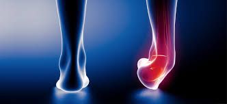 ankle instability