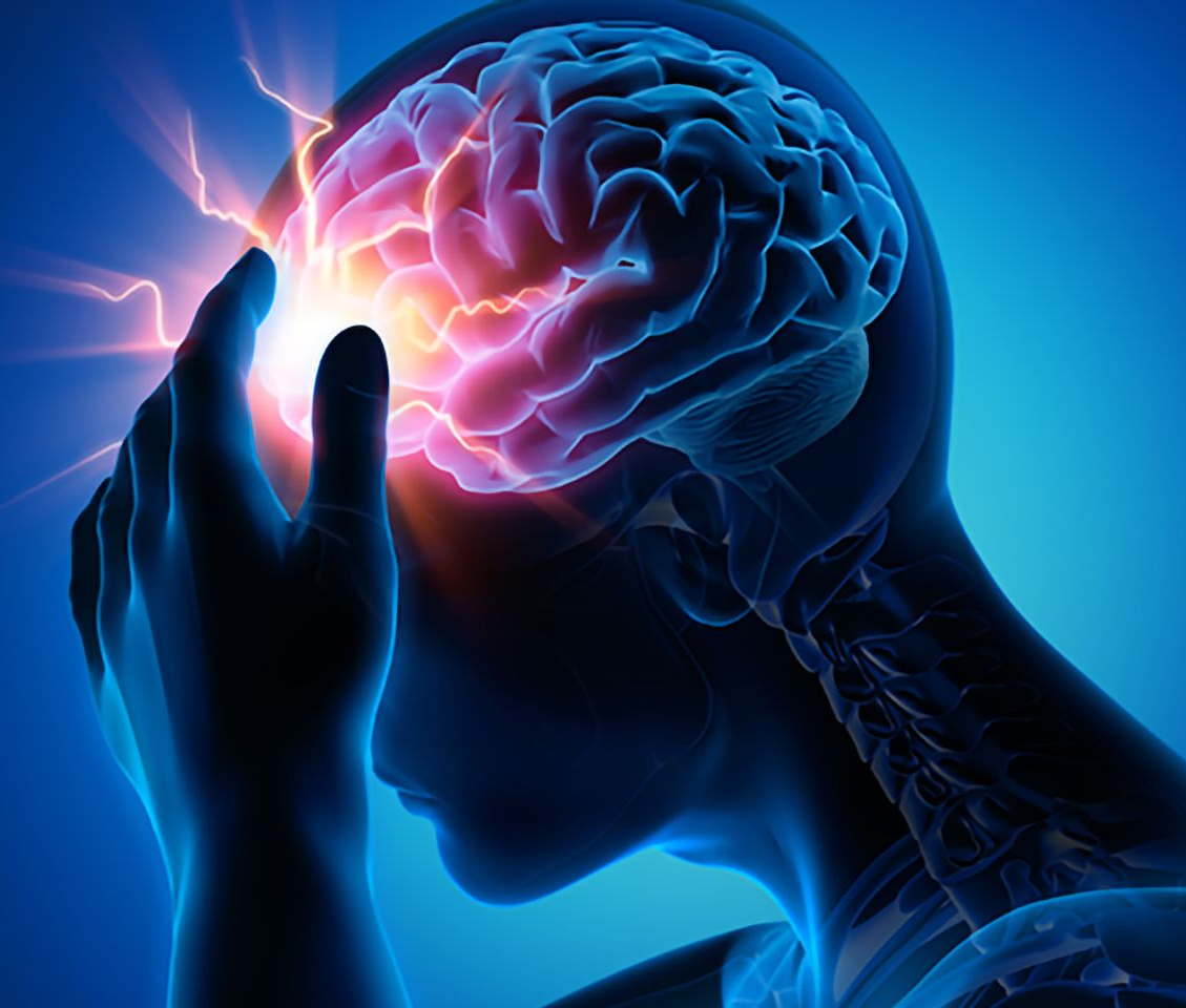 concussion