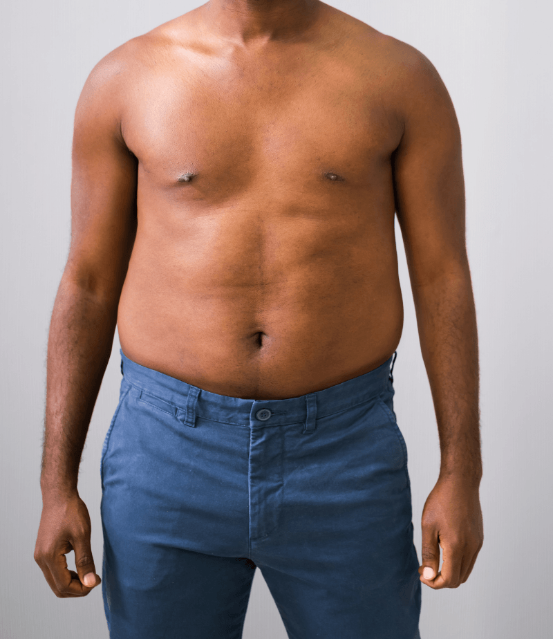 before weight loss