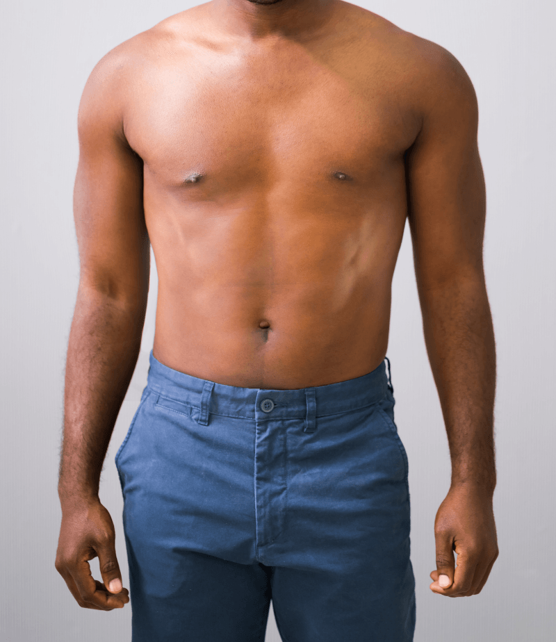 after weight loss