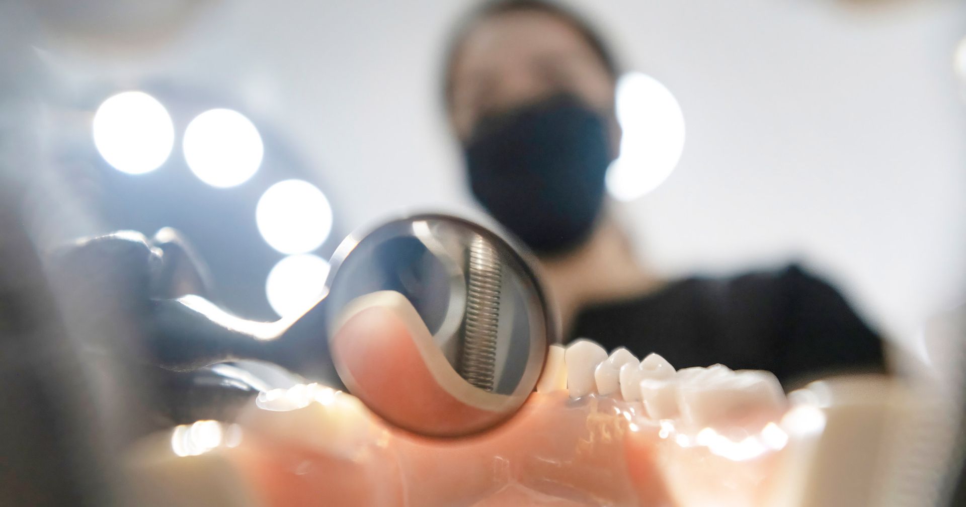 can dental implants get infected
