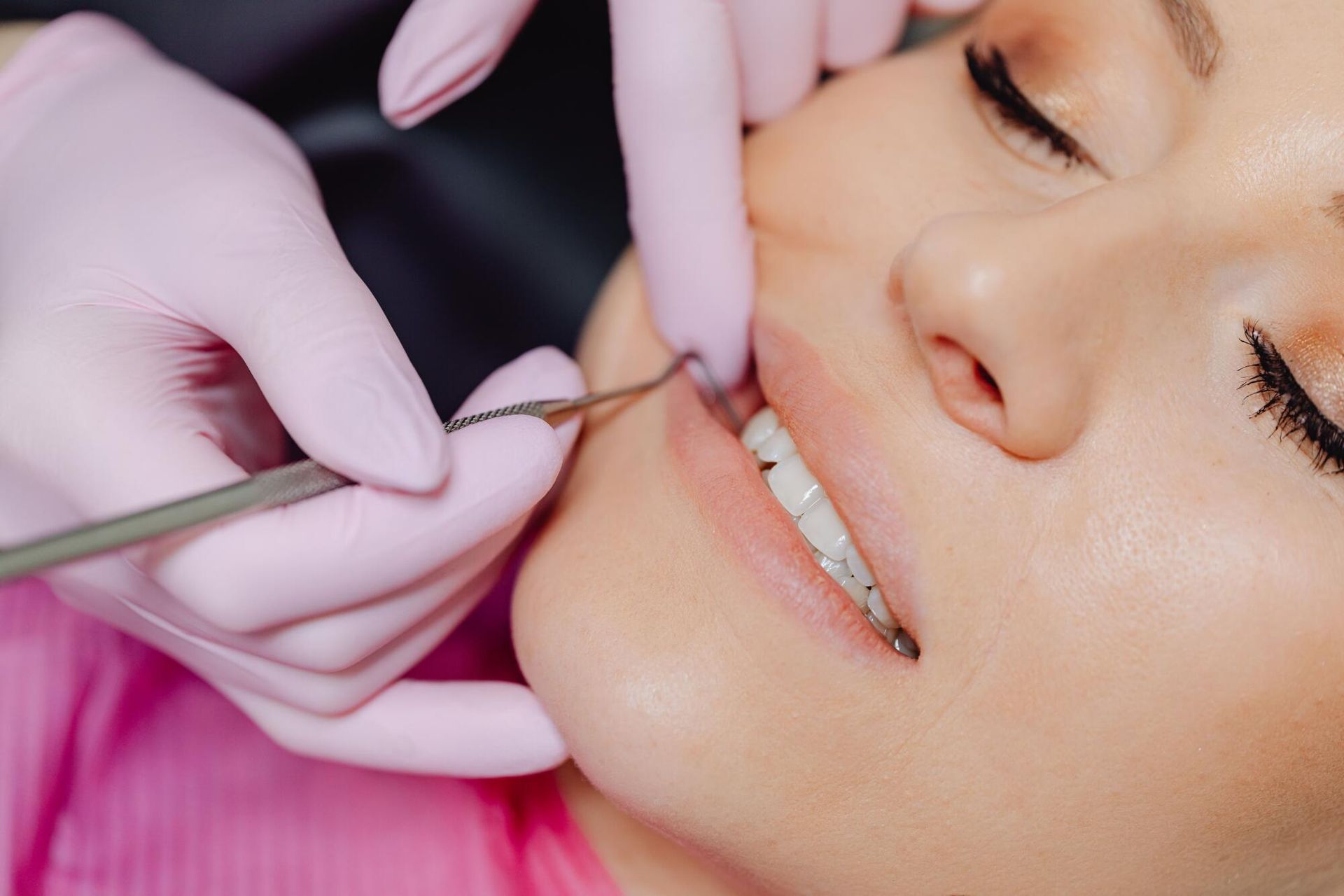 Gloved hands applying dental braces to a smiling person’s teeth in a close-up exam view