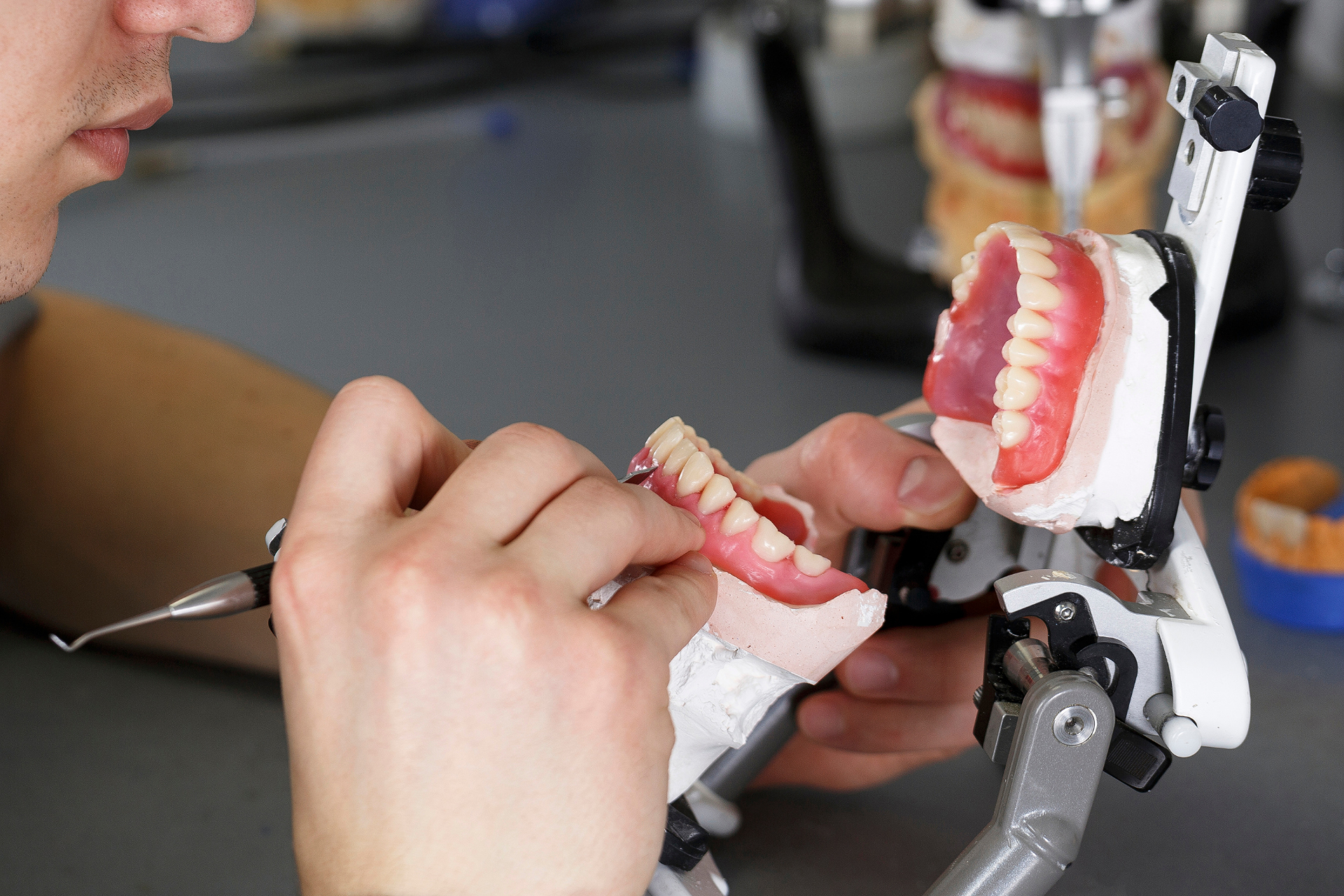 Side-by-side photos of a person smiling before and after dental implant surgery with 3D-printed prosthesis.