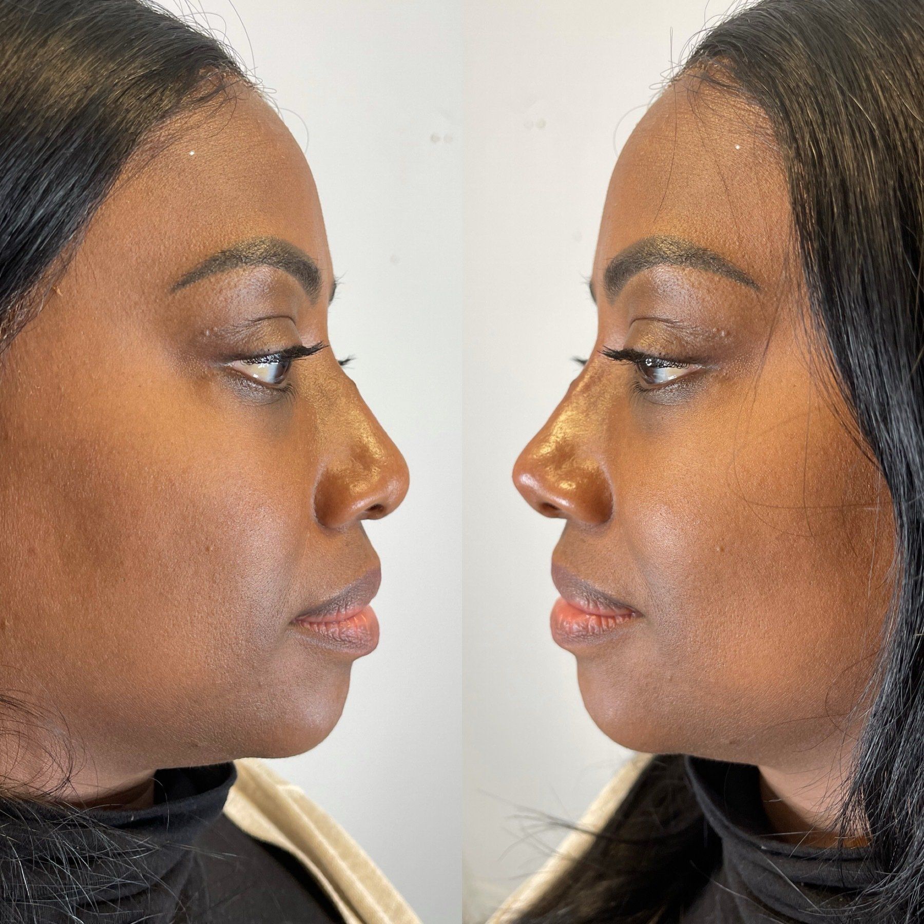 A woman with a healthy skin