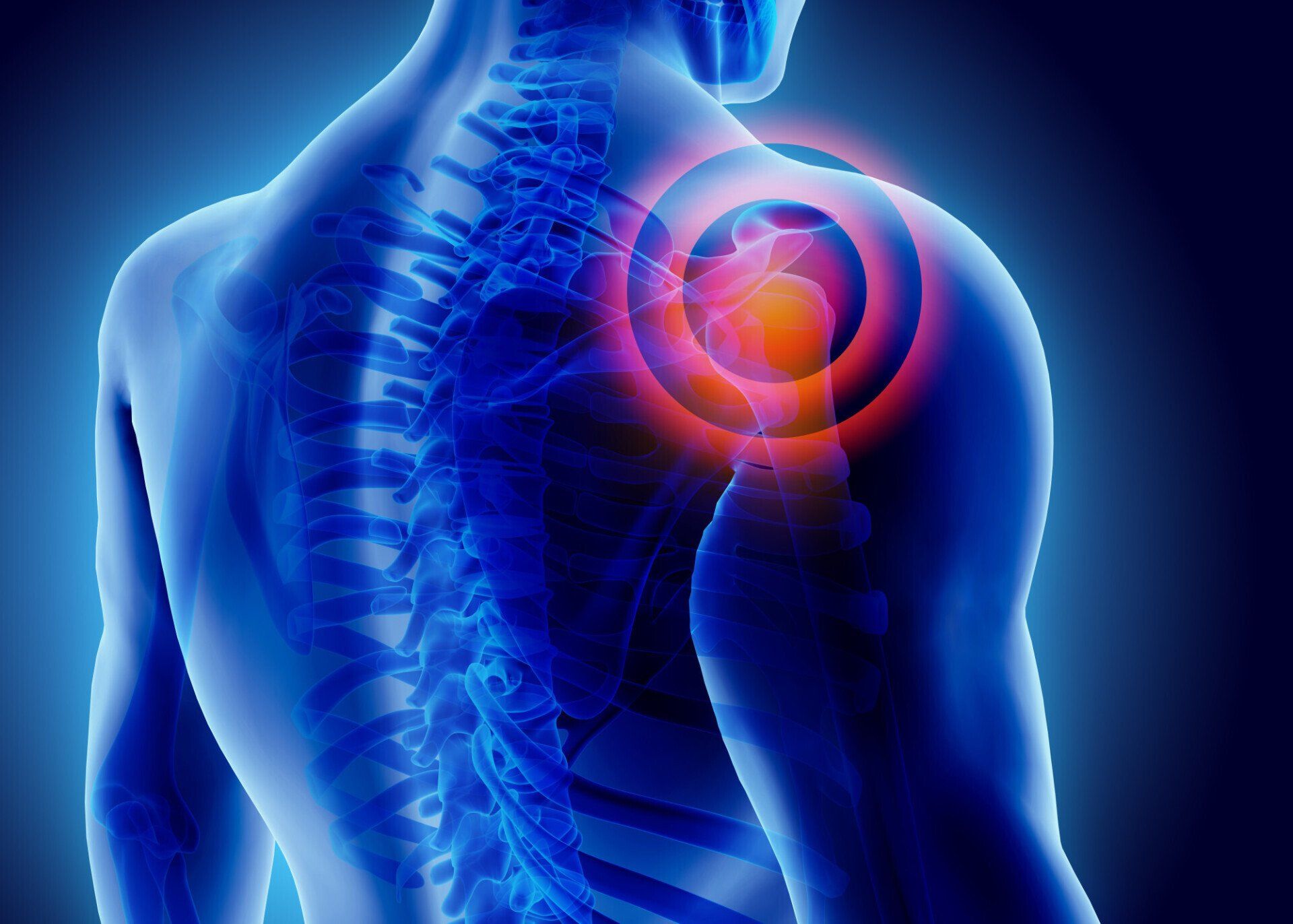Kinesio taping for shoulder