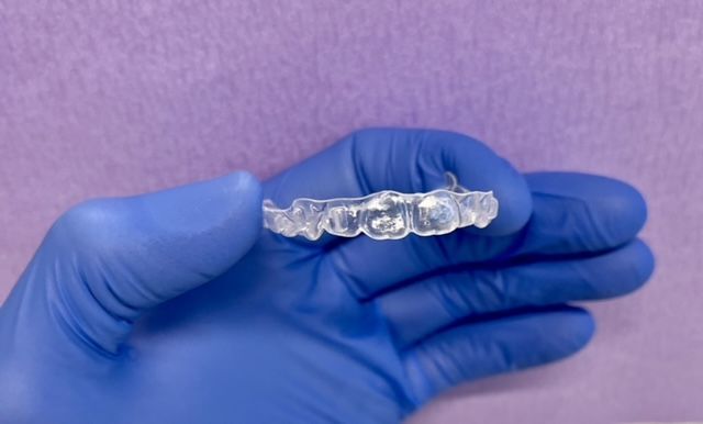 Mano guantata che regge un allineatore dentale trasparente su sfondo viola
