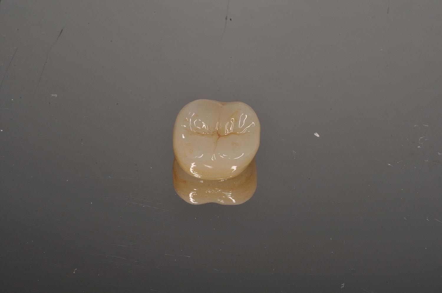 Corona dentale singola su superficie scura, che mostra un restauro beige e bianco a forma di dente.