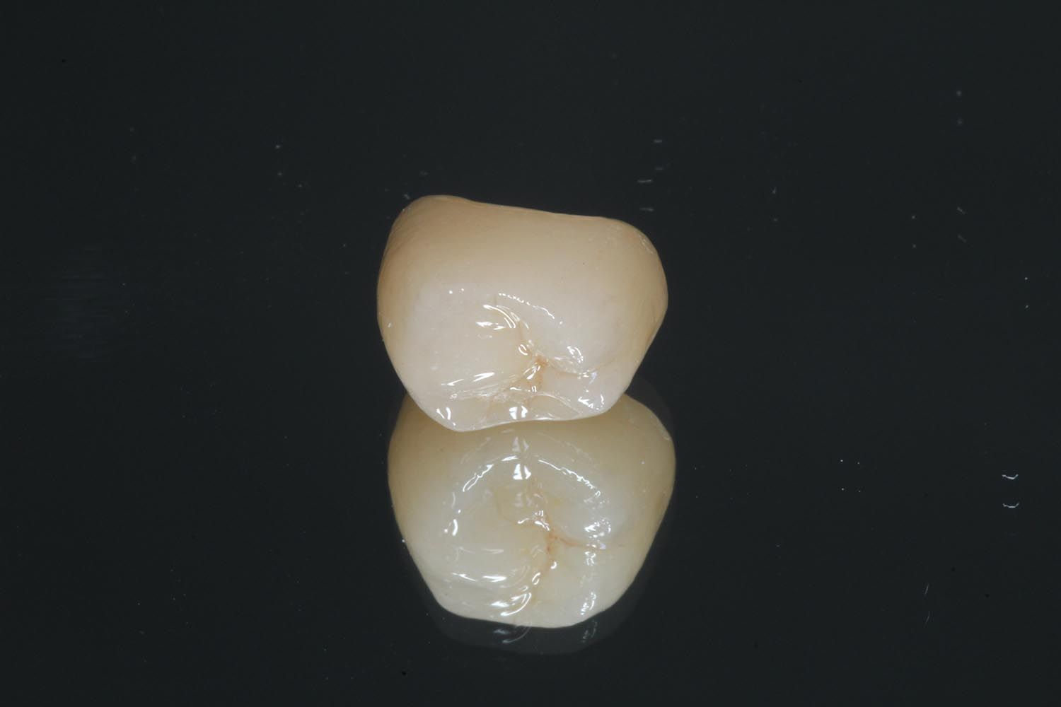 Due corone dentali bianche su sfondo scuro