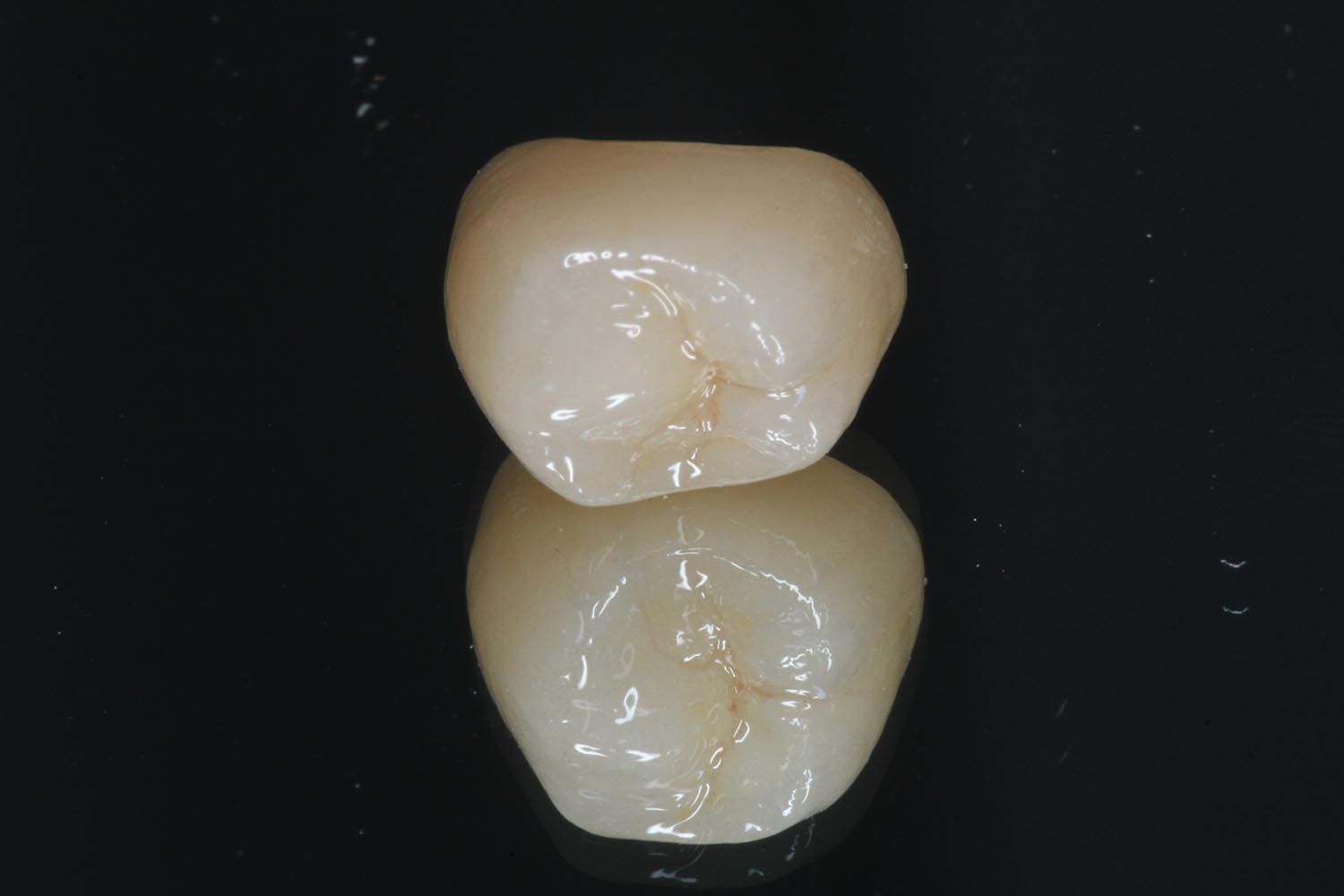 Due corone dentali bianche sovrapposte su sfondo nero.