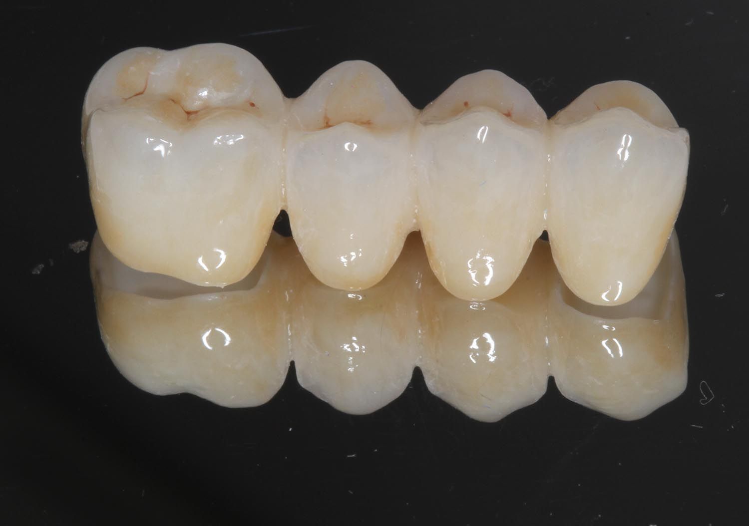 Quattro corone dentali bianche su una superficie nera riflettente.
