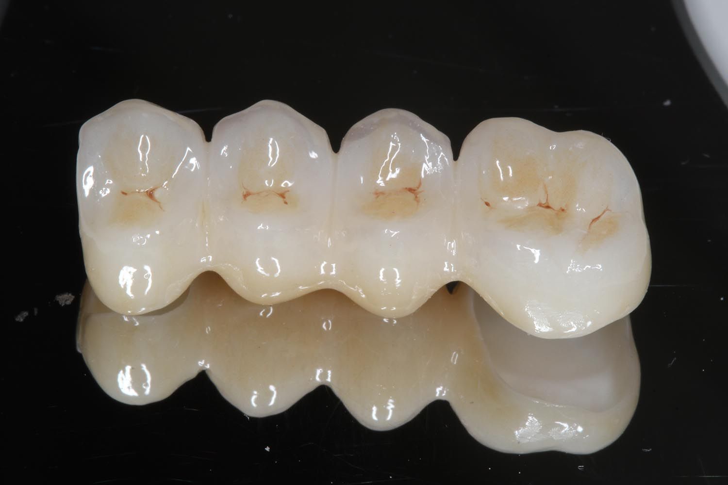 Ponte o corone dentali bianche su una superficie nera riflettente con riflesso a specchio