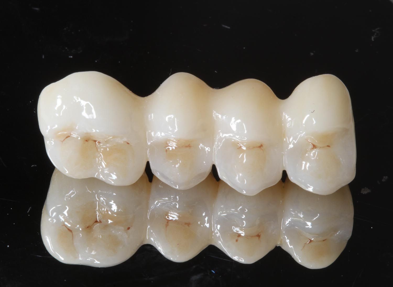 Una fila di quattro corone dentali bianche su una superficie riflettente nera