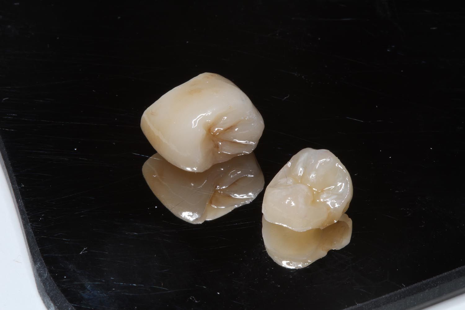 Due piccole corone dentali bianche su una superficie nera lucida, con riflessi sottostanti