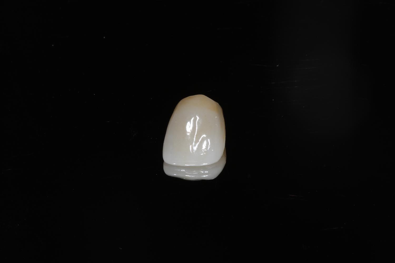 Piccolo oggetto arrotondato di colore bianco sporco, centrato su uno sfondo nero.
