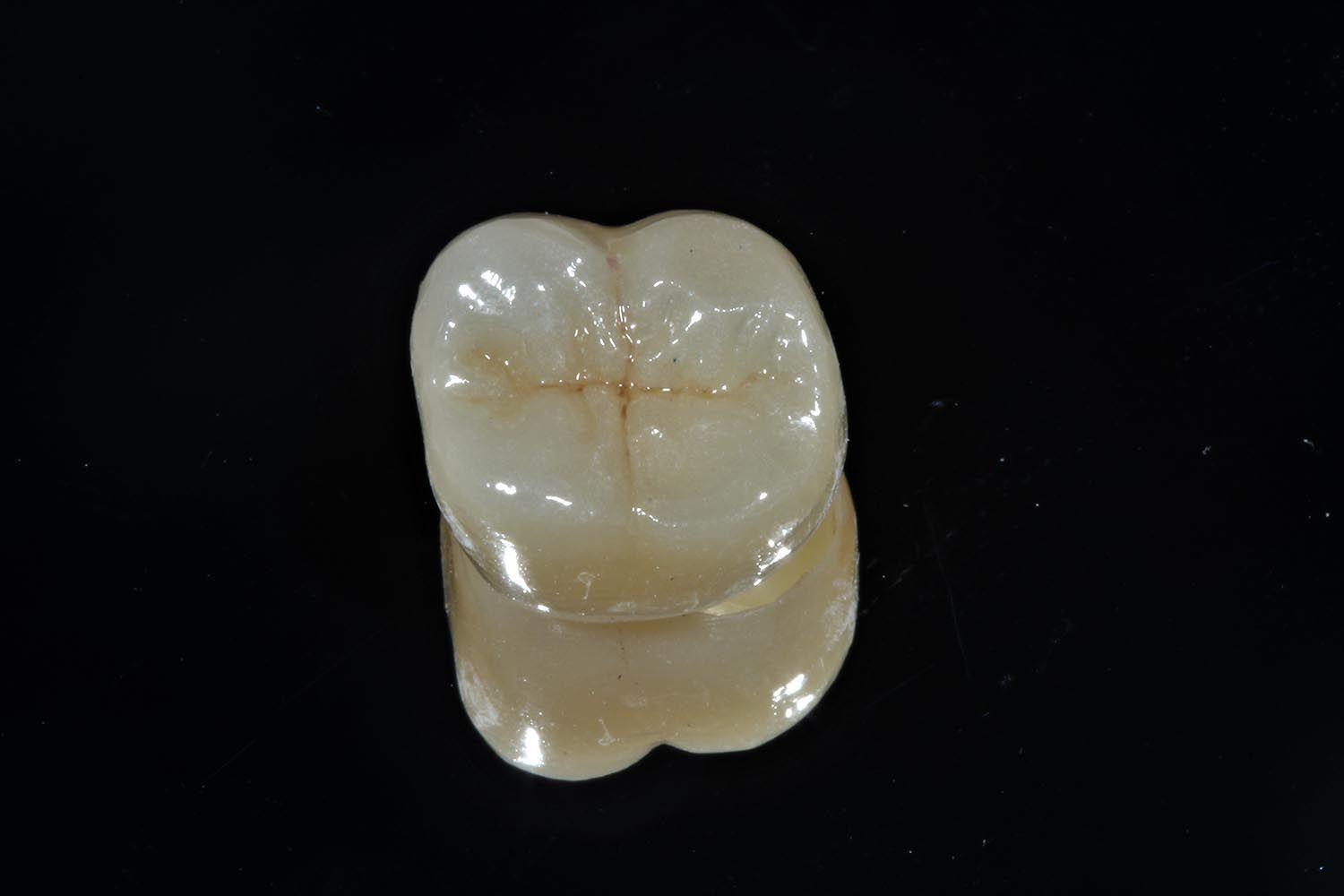Primo piano di un dente molare bianco su sfondo nero.