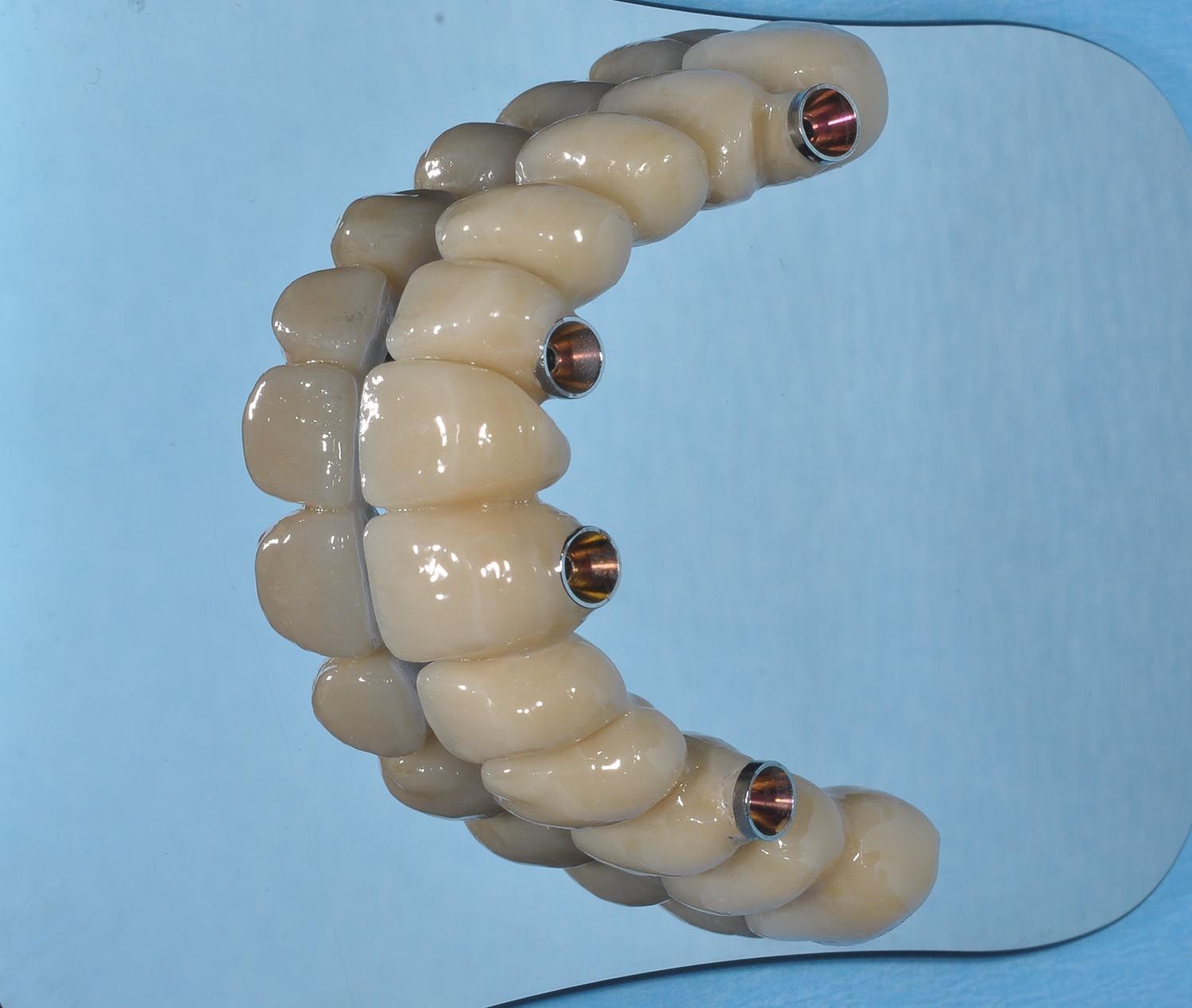 Protesi dentaria curva color bianco sporco con ganci metallici su sfondo blu.