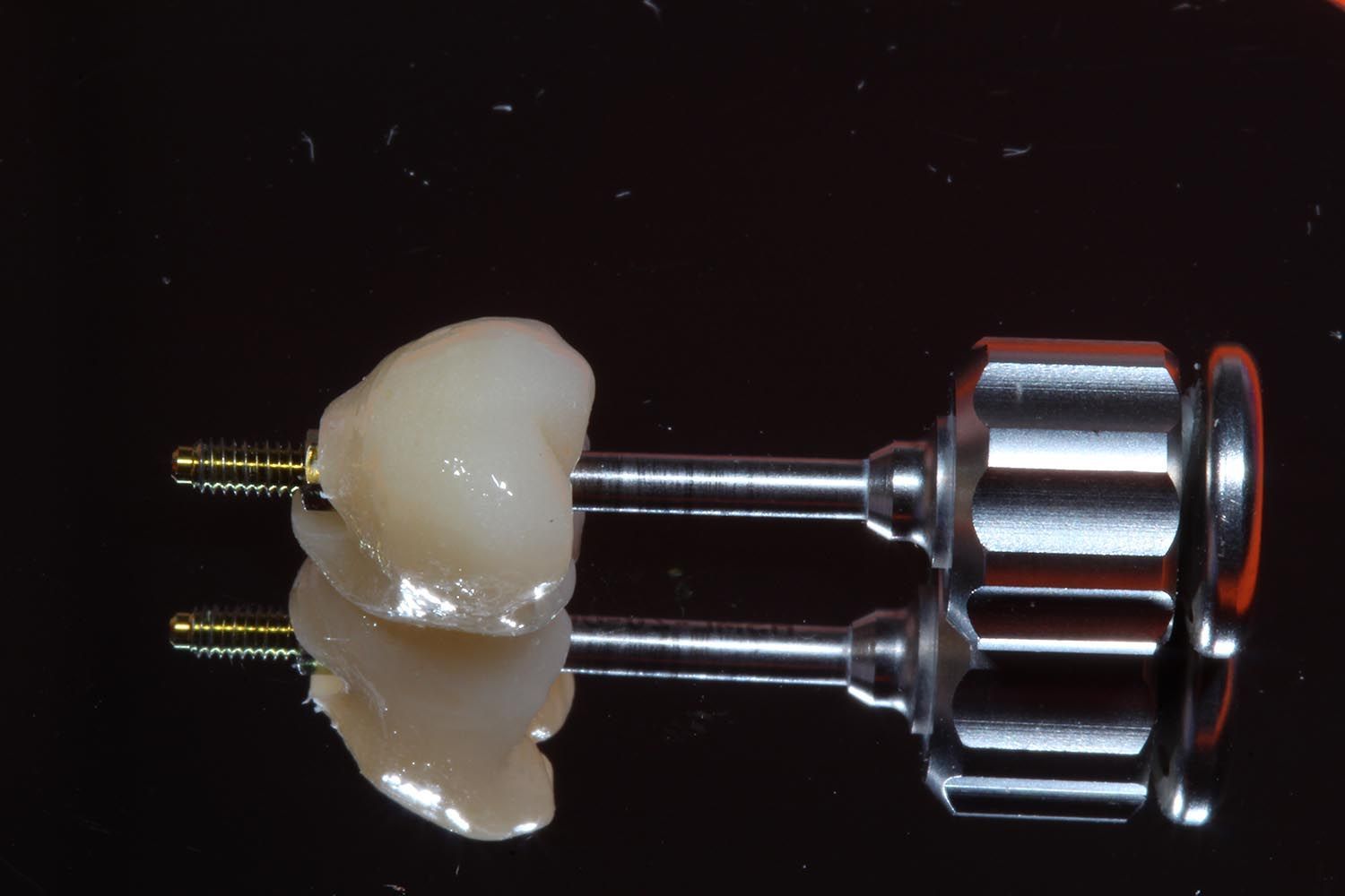 Due corone dentali su perni metallici su sfondo nero
