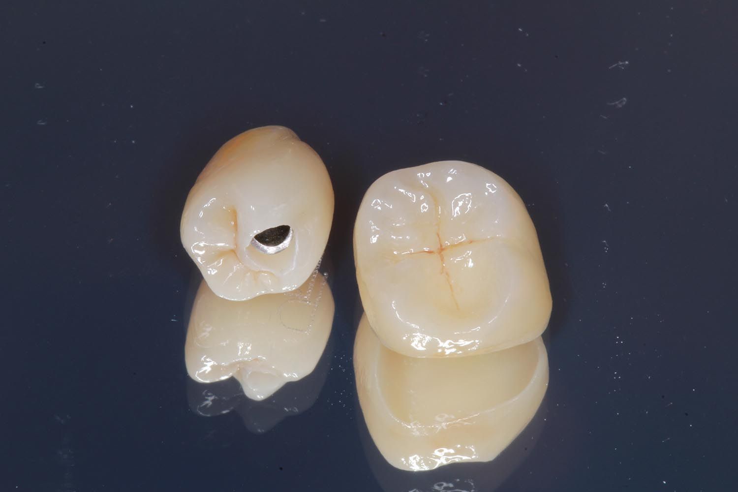 Due corone dentali bianche su una superficie scura, una delle quali mostra un foro simile a una carie.