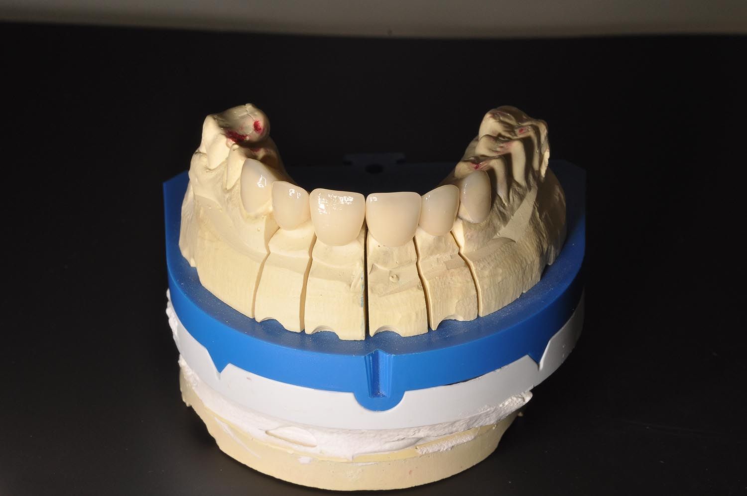 Modello di calco dentale con base blu e denti beige su sfondo nero.