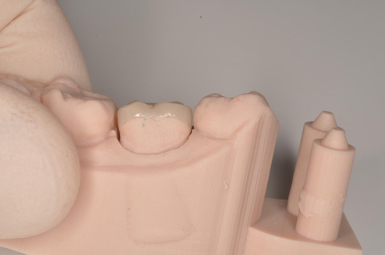 Primo piano di denti e gengive di un modellino dentale di colore rosa pallido, con un polpastrello che tocca il dente superiore sinistro.