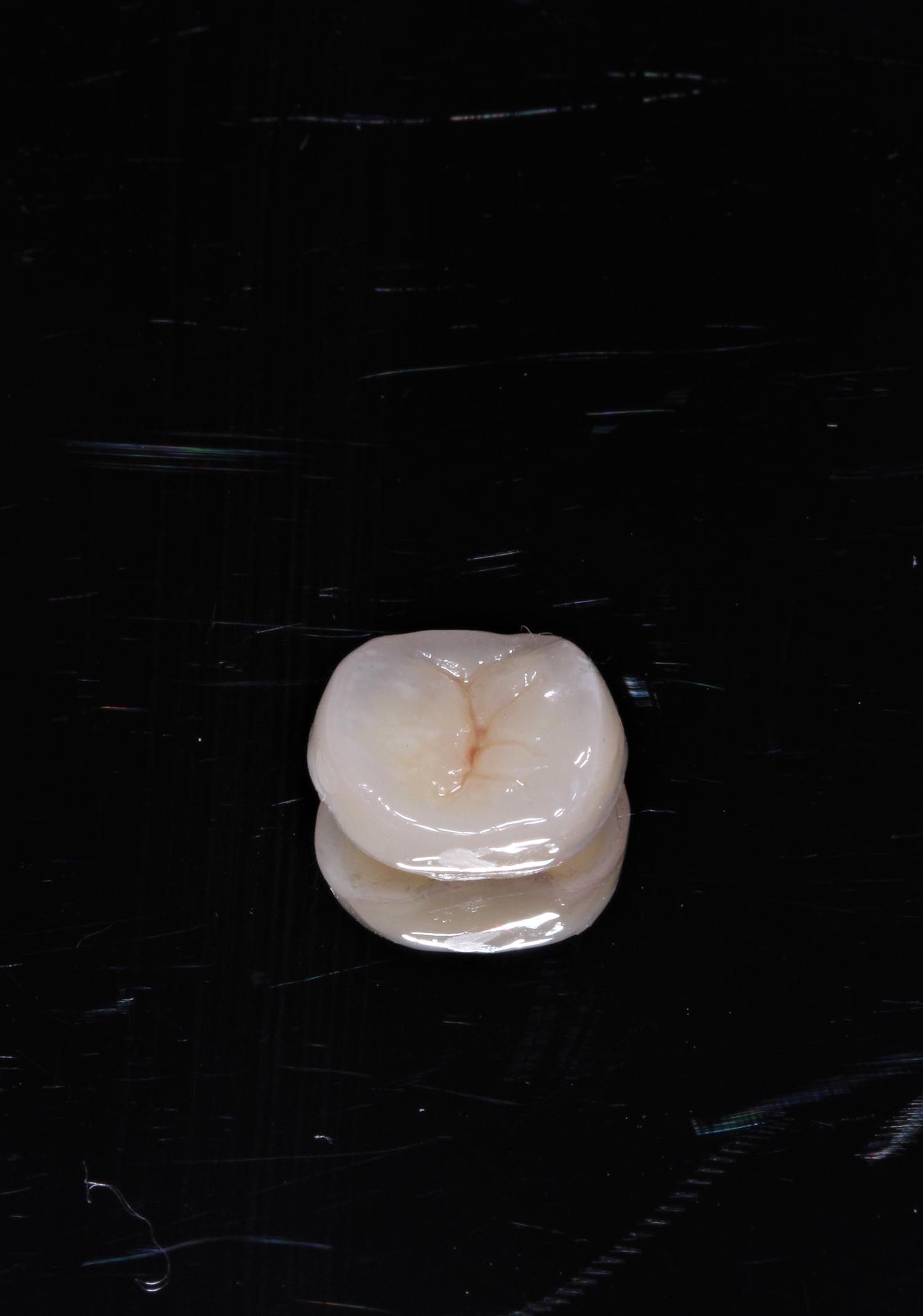 Primo piano di un piccolo dente bianco su sfondo nero.
