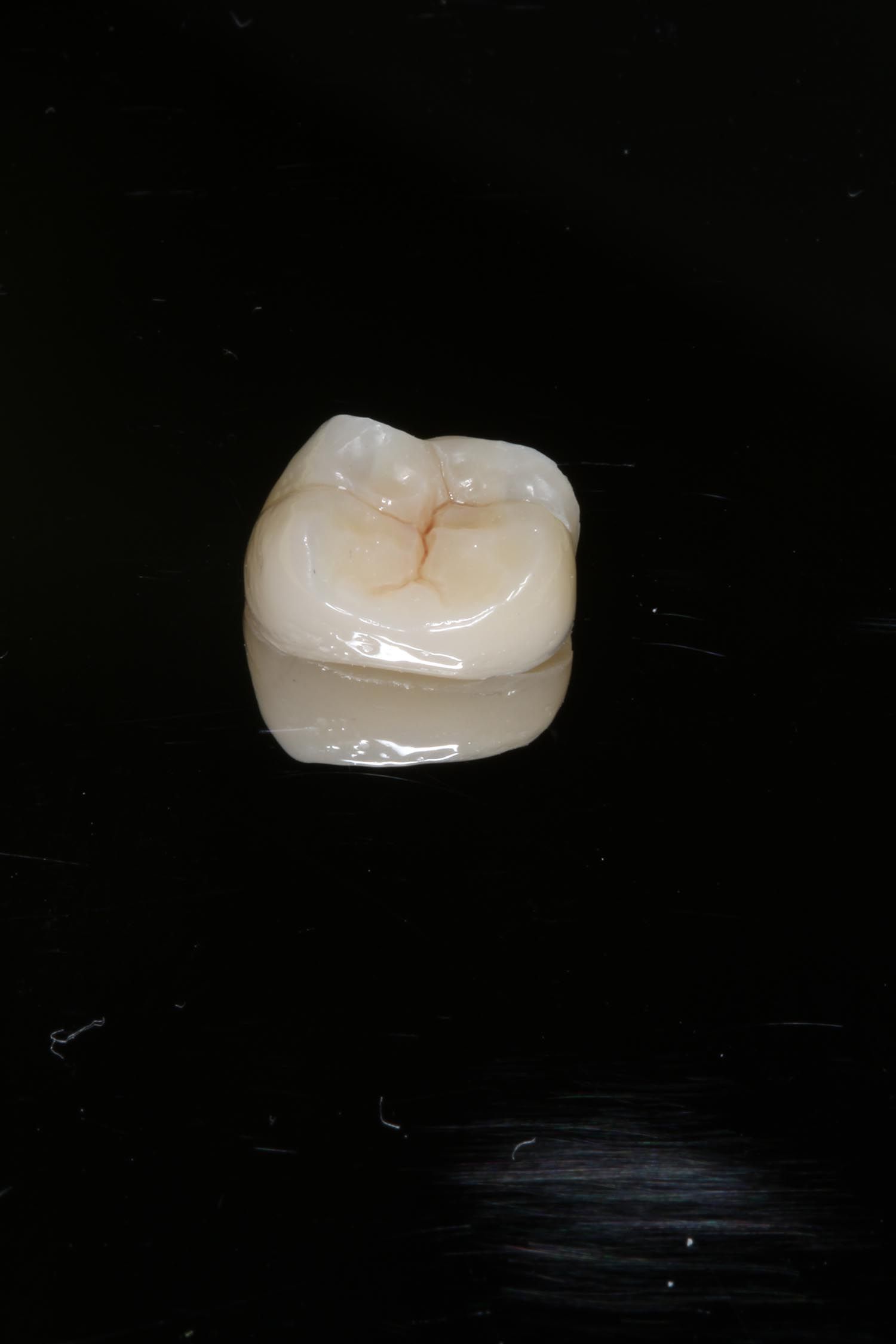 Singolo dente molare bianco su sfondo nero