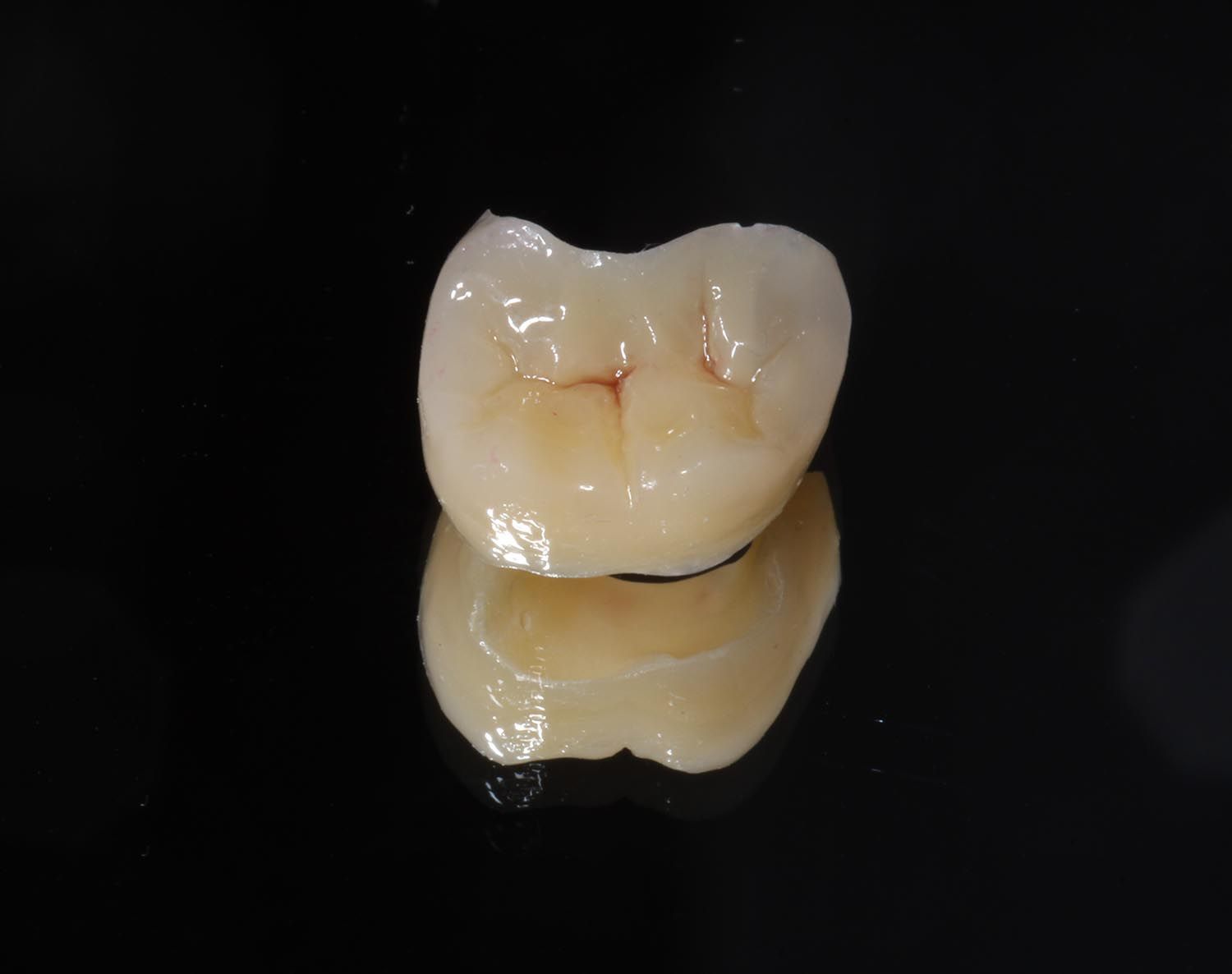 Dente molare umano singolo, color crema, isolato su sfondo nero.
