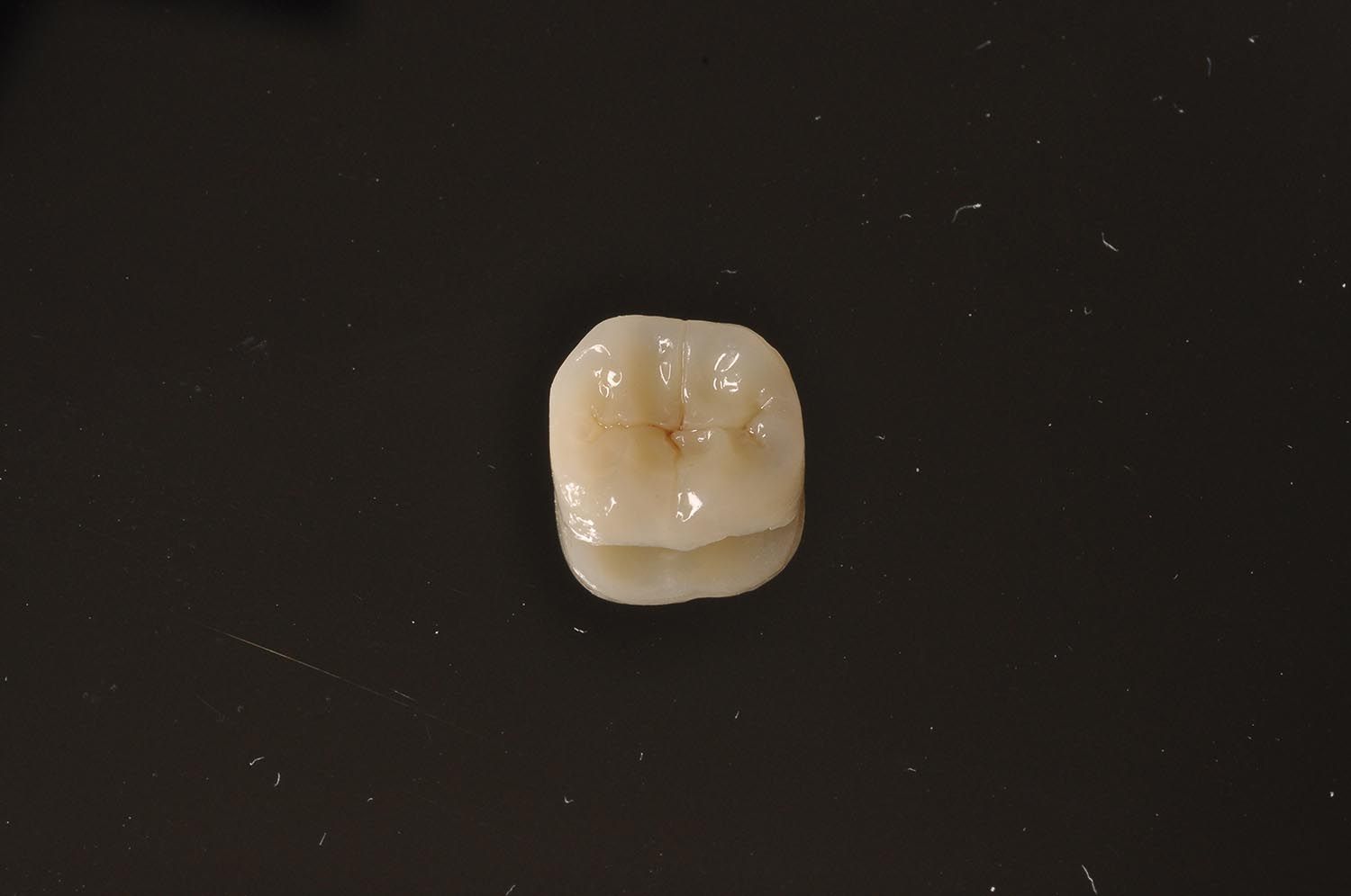 Piccola corona dentale color bianco sporco su sfondo nero.