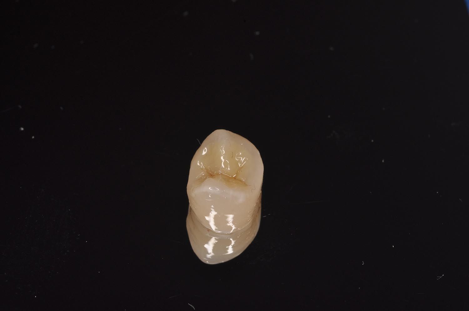Piccolo oggetto beige a forma di seme, centrato su sfondo nero.