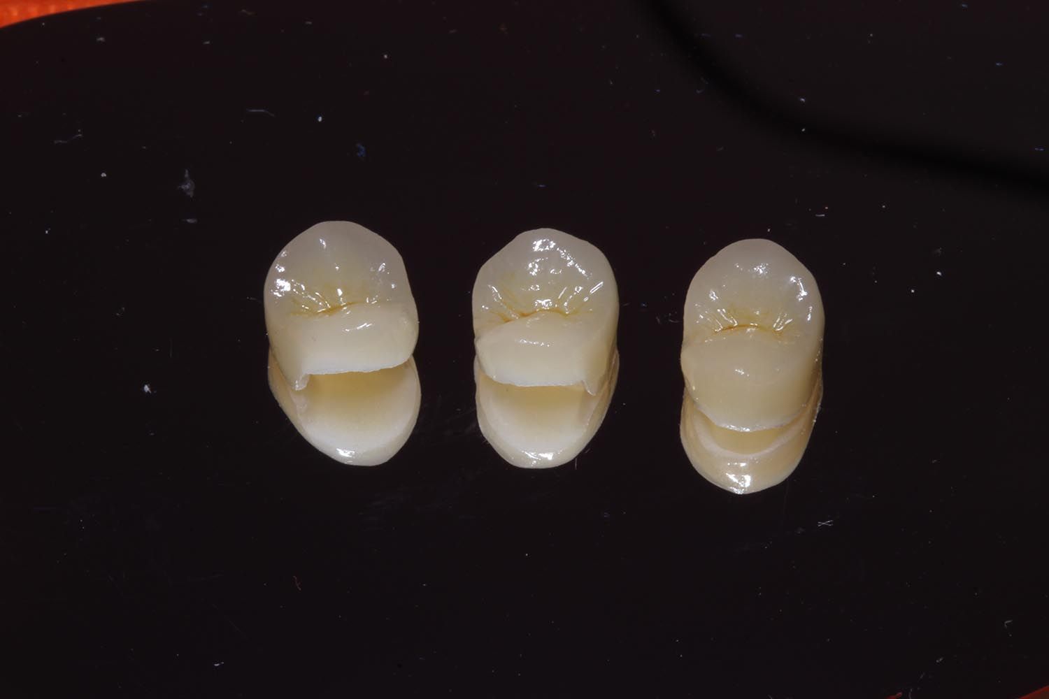 Tre piccoli oggetti a forma di conchiglia color crema, disposti in fila su uno sfondo scuro.
