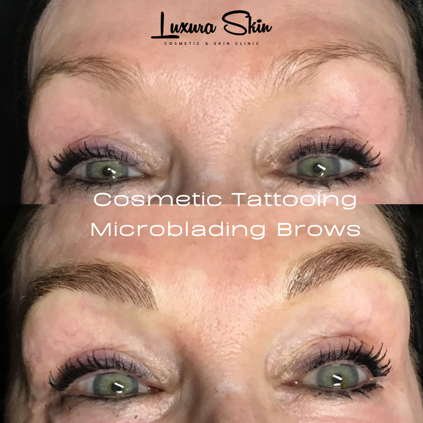 Cosmetic Tattooing